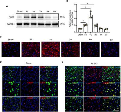 Cannabinoid receptor-2 attenuates neuroinflammation by promoting autophagy-mediated degradation of the NLRP3 inflammasome post spinal cord injury